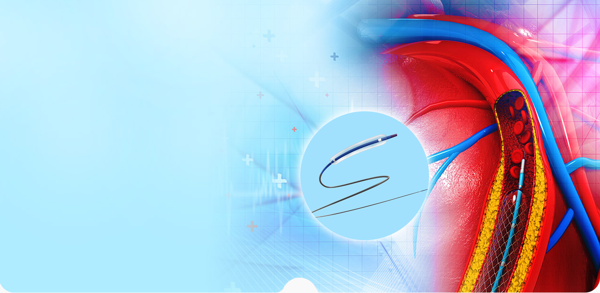 НИНБО LINSTANT ПОЛИМЕРНЫЕ МАТЕРИАЛЫ CO,. ООО.