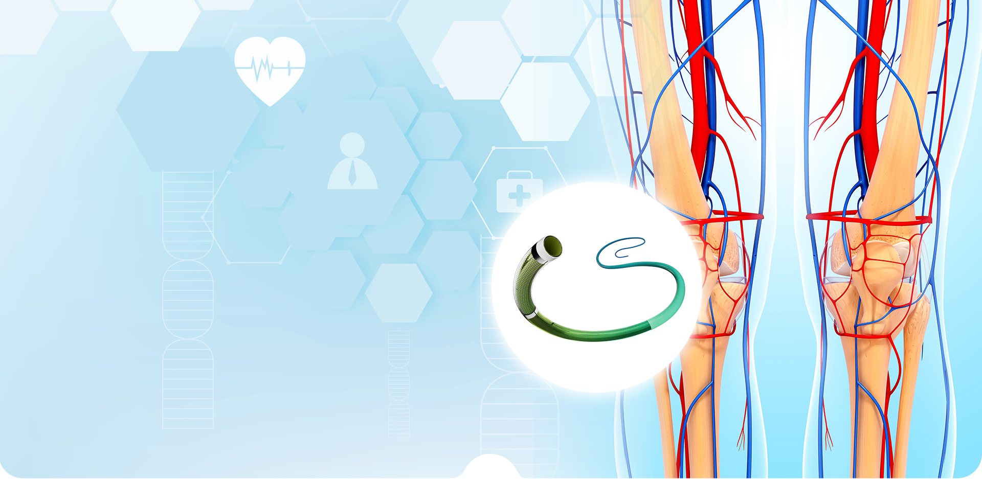 НИНБО LINSTANT ПОЛИМЕРНЫЕ МАТЕРИАЛЫ CO,. ООО.